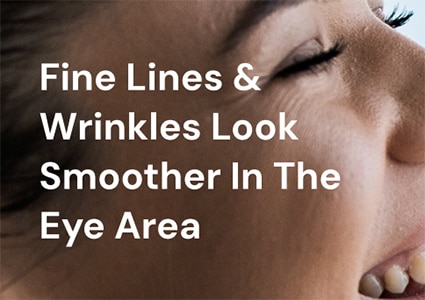 Fine lines and wrinkles look smoother